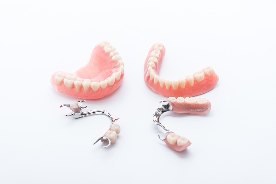 A Complete Guide to Dentures in San Jose, CA: Restoring Your Smile and Confidence