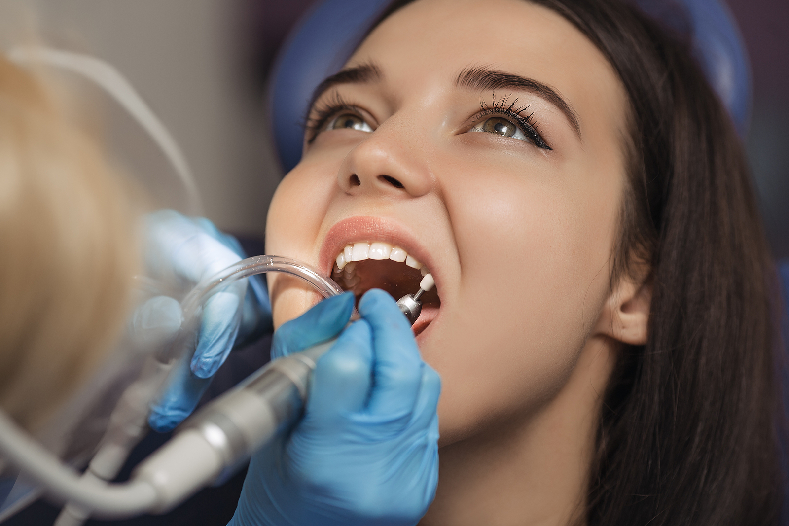 How to Prevent Dry Sockets After a Tooth Extraction