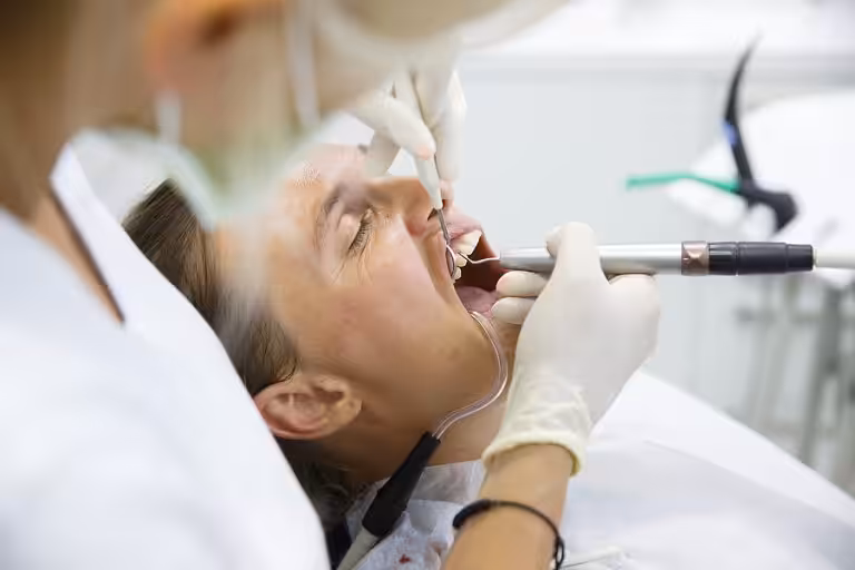 Extractions in san jose ca 768x512