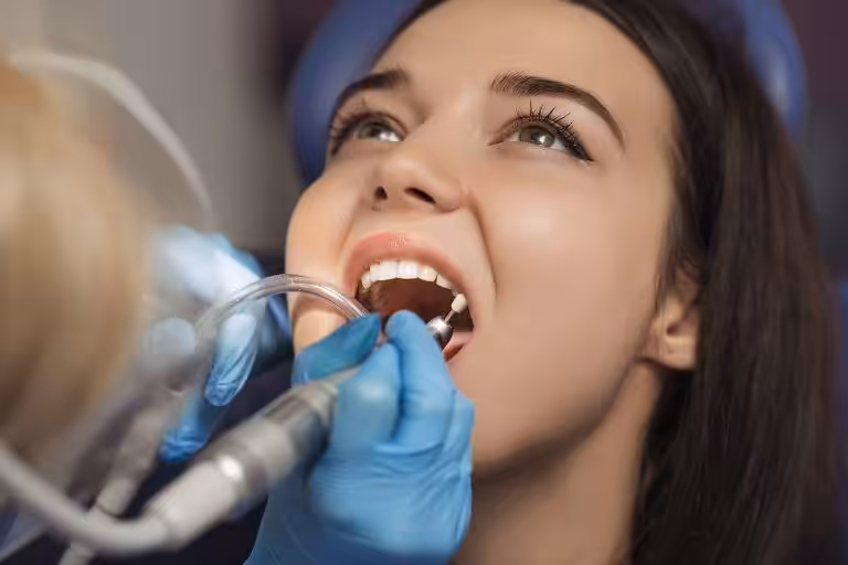 Teeth extraction in san jose ca 768x512